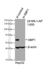 XBP1 Antibody in Western Blot (WB)