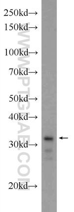 XBP1 Antibody in Western Blot (WB)