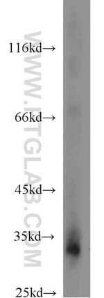 XBP1 Antibody in Western Blot (WB)