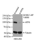 ATF6 Antibody in Western Blot (WB)