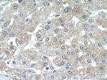 CRP Antibody in Immunohistochemistry (Paraffin) (IHC (P))