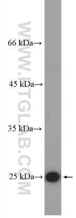 CRP Antibody in Western Blot (WB)