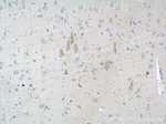 ALK/CD246 Antibody in Immunohistochemistry (Paraffin) (IHC (P))