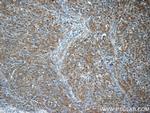 ALK/CD246 Antibody in Immunohistochemistry (Paraffin) (IHC (P))