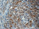 ALK/CD246 Antibody in Immunohistochemistry (Paraffin) (IHC (P))