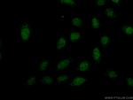 PREX2 Antibody in Immunocytochemistry (ICC/IF)