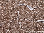 PREX2 Antibody in Immunohistochemistry (Paraffin) (IHC (P))