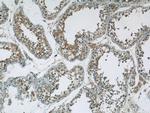 GSK3B Antibody in Immunohistochemistry (Paraffin) (IHC (P))