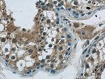 GSK3B Antibody in Immunohistochemistry (Paraffin) (IHC (P))