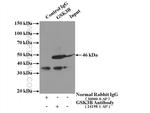 GSK3B Antibody in Immunoprecipitation (IP)