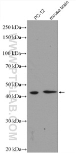 GSK3B Antibody in Western Blot (WB)