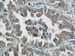 ROMO1 Antibody in Immunohistochemistry (Paraffin) (IHC (P))