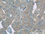 ROMO1 Antibody in Immunohistochemistry (Paraffin) (IHC (P))