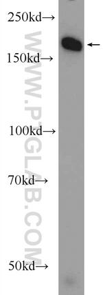 DNMT1 Antibody in Western Blot (WB)