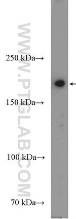 DNMT1 Antibody in Western Blot (WB)