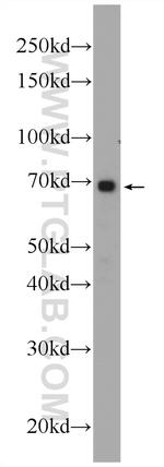 ANKRD53 Antibody in Western Blot (WB)