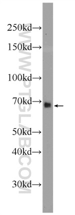 ANKRD53 Antibody in Western Blot (WB)