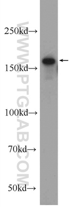 ERCC6/CSB Antibody in Western Blot (WB)