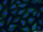 F2 Antibody in Immunocytochemistry (ICC/IF)