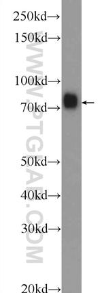 F2 Antibody in Western Blot (WB)