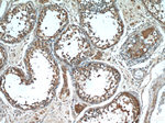 cIAP2 Antibody in Immunohistochemistry (Paraffin) (IHC (P))