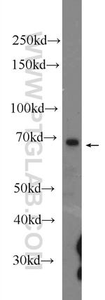 cIAP2 Antibody in Western Blot (WB)