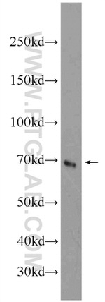 cIAP2 Antibody in Western Blot (WB)