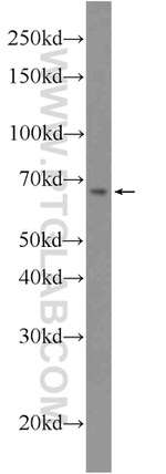 LARGE Antibody in Western Blot (WB)