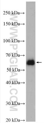 EEPD1 Antibody in Western Blot (WB)