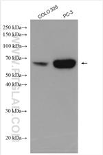 EEPD1 Antibody in Western Blot (WB)