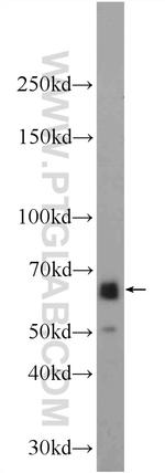 EEPD1 Antibody in Western Blot (WB)