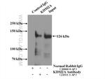 KDM2A Antibody in Immunoprecipitation (IP)