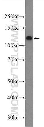 KDM2A Antibody in Western Blot (WB)