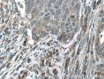 CAMK1 Antibody in Immunohistochemistry (Paraffin) (IHC (P))