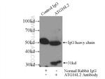 ATG16L2 Antibody in Immunoprecipitation (IP)