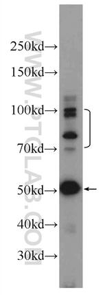 Sodium Iodide Symporter Antibody in Western Blot (WB)