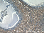 Sodium Iodide Symporter Antibody in Immunohistochemistry (Paraffin) (IHC (P))