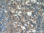 Sodium Iodide Symporter Antibody in Immunohistochemistry (Paraffin) (IHC (P))