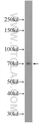 SGLT3/SLC5A4 Antibody in Western Blot (WB)