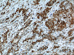 Cadherin-17 Antibody in Immunohistochemistry (Paraffin) (IHC (P))