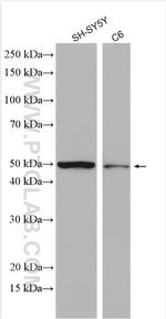 UGT2A1 Antibody in Western Blot (WB)