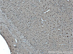 ABCA8 Antibody in Immunohistochemistry (Paraffin) (IHC (P))