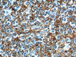 CD21 Antibody in Immunohistochemistry (Paraffin) (IHC (P))