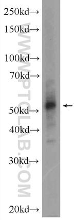 SETD6 Antibody in Western Blot (WB)