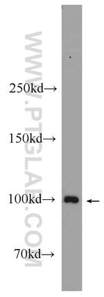 ACTN3 Antibody in Western Blot (WB)