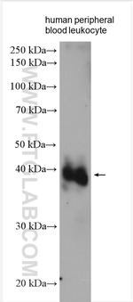 VSTM1 Antibody in Western Blot (WB)