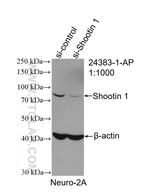 KIAA1598 Antibody in Western Blot (WB)