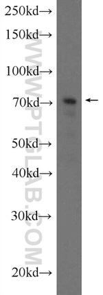 C17orf85 Antibody in Western Blot (WB)