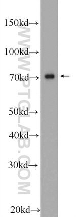 C17orf85 Antibody in Western Blot (WB)