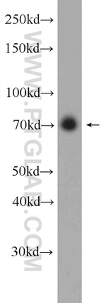 C17orf85 Antibody in Western Blot (WB)